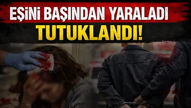 Eşini Başından Yaraladı, Tutuklandı
